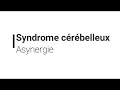 Syndrome crbelleux  asynergie