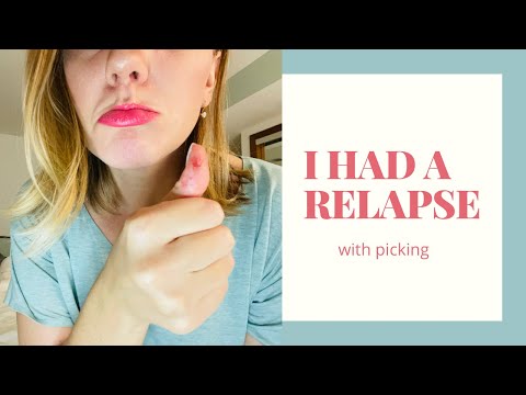 I HAD A RELAPSE - with skin picking. AKA dermatillomania... and how I got back on track
