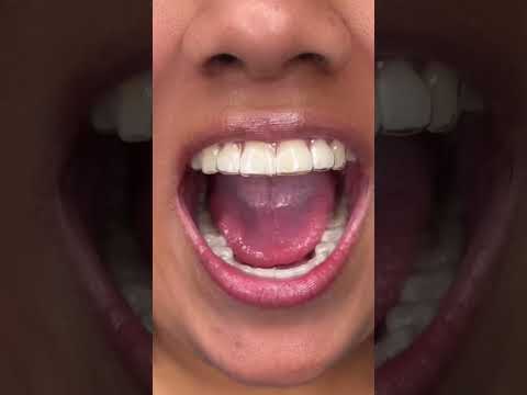 كم سنة لازم تحط المثبت بعد التقويم