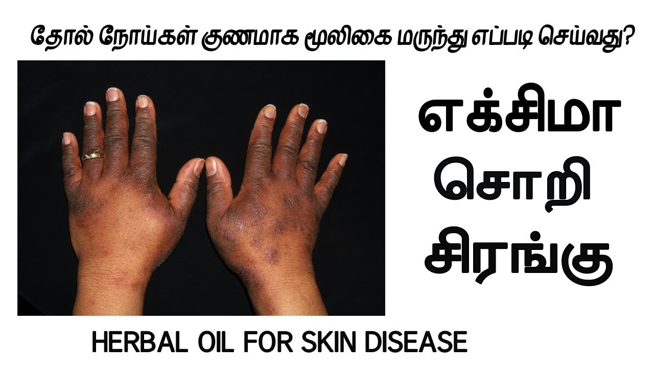 eczema treatment for dogs எக்சிமா தோல் நோய் குணமாக மூலிகை மருந்து தயாரிக்கும் முறை | herbal medicine for skin disease