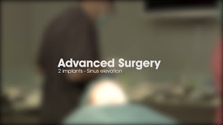 Advanced Surgery - Two Implants Sinus Elevation