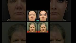 From Natural Beauty to Celebrity-Inspired: A Journey Through Filters