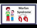 Le syndrome de marfan maladie mfs cause symptme traitement enfant anvrisme laorte prolapsus 3 mn