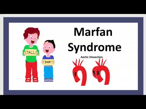 Le Syndrome de Marfan Maladie MFS Cause Symptôme Traitement Enfant Anévrisme L&rsquo;Aorte Prolapsus 3 mn