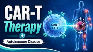 CAR-T cell therapy in autoimmune disease resets immune system #autoimmunedisease #lupustreatment