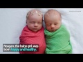 Photographer captures twin baby's last moments