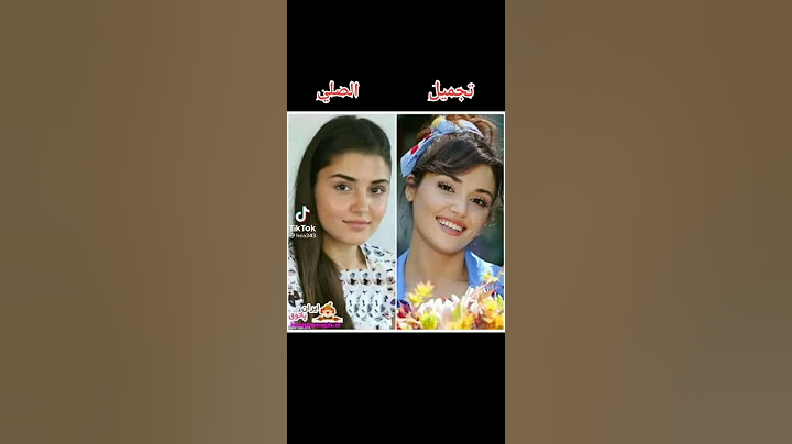 اشهر الممثلات التركيات قبل وبعد عمليات التجميل ؟؟