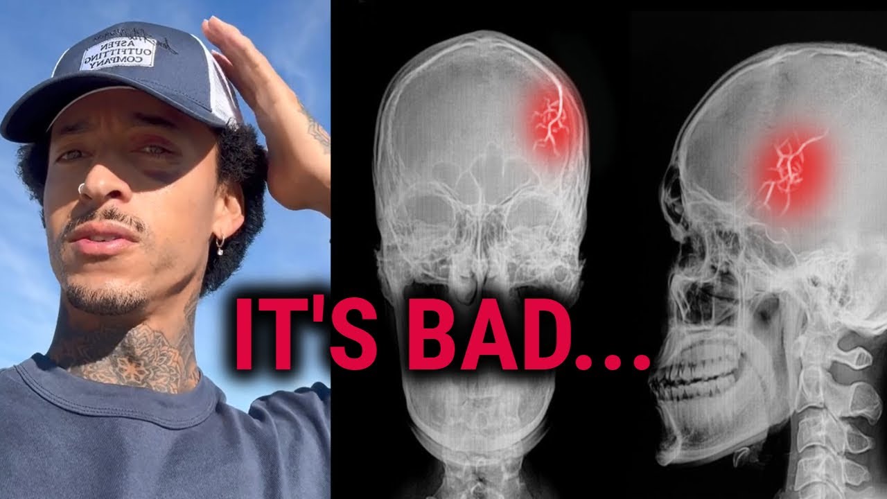 NYJAH'S SEVERE INJURY DETAILS