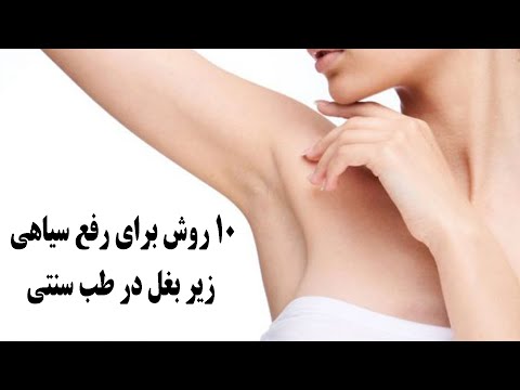 10 روش برای رفع سیاهی زیر بغل در طب سنتی 