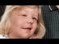 Reportage - Het Meisje Met Het Halve Gezicht | 2014