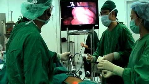 Laparoscopic appendectomy part 3