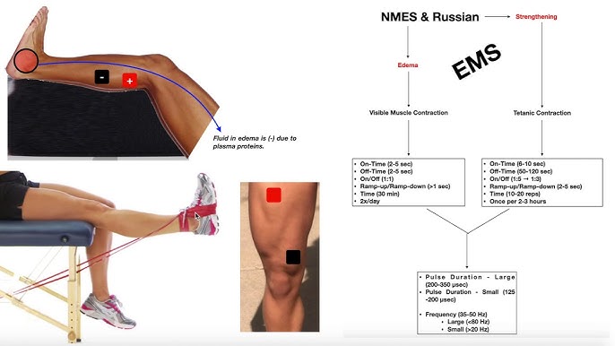 How to prepare for Neuromuscular Electrical Stimulation (NMES)? 