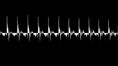 [Audio Backup] Sargon