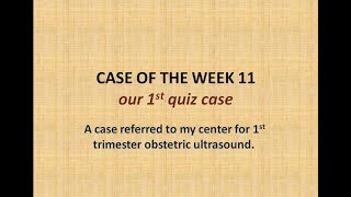 case of the week 11  quiz