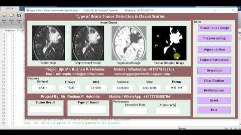Brain Tumor Types Detection Using Image Processing IEEE Based Project Matlab Project Source Code