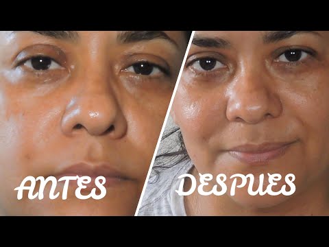 Cafe con aceite de coco para combatir ojeras - @maribelcentenoruiz4674
