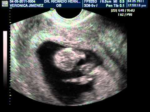 como es tu bebe a las 8 semanas