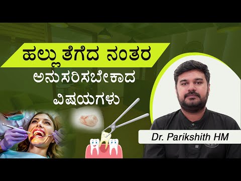 Things To Follow After Tooth Extraction Tooth Removal Kannada Dr Parikshith HM Kannadahealth