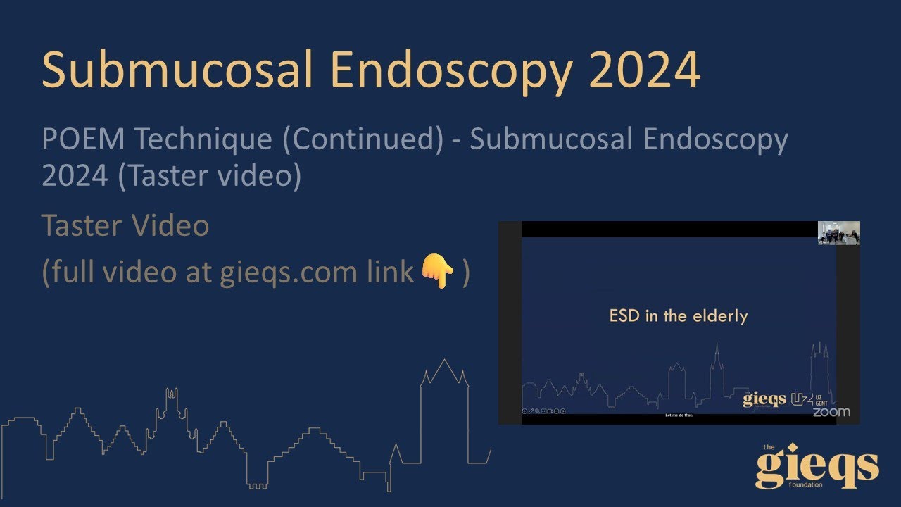 POEM Technique (Continued) - Submucosal Endoscopy 2024 (Taster video)
