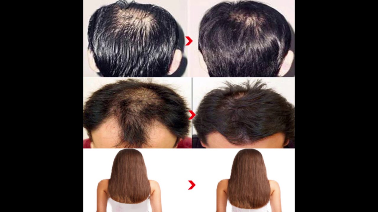 REPOUSSER ET NOURRIR LES CHEVEUX AVEC LE GINSENG 🌿 - YouTube