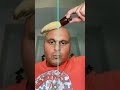 Bald Guy Gets His Hair Back رجل أصلع يستعيد شعره 