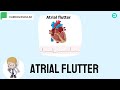 Atrial flutter symptoms ecg features and treatment options