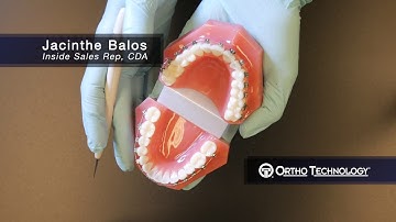 Lotus Plus DS, Self-Ligating Bracket System | Ortho Technology