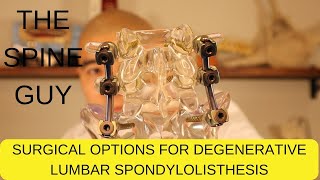 Surgical Options for Degenerative Lumbar Spondylolisthesis  Part 3