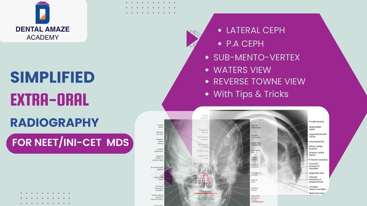 Extraoral radiography Simplified (For NEET/INICET MDS 202324) YouTube