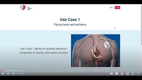 SimCardioTest UC1 demo video showing pacing device simulation.