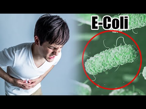 Vídeo: Infección Por E. Coli: Causas, Síntomas, Prevención, Riesgos Y Más