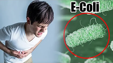 ¿Cuáles son los tres síntomas de la infección intestinal por E. coli?
