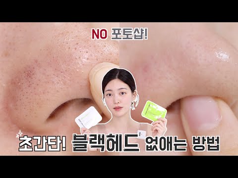 ✨초초간단 블랙헤드 없애는 <strong>방법</strong>✨ • 블랙헤드 관리법 • 블랙헤드 인생템 | CHES <strong>체스</strong>