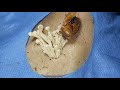 Calming Acne Therapy โ Gentle ASMR Skin Transformation