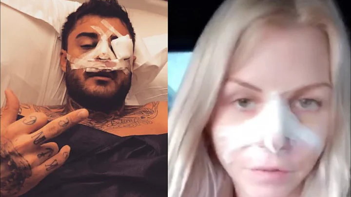 Jessica et Thibault se sont REFAIT le nez ! Ils ex...