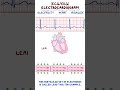 Clinical Cuts: ECG Basics