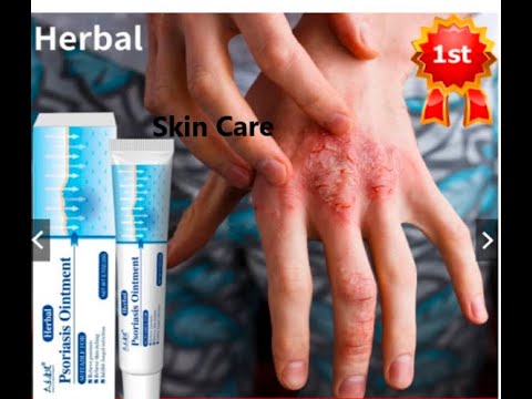 Antibacterial Herbal Cream Anti-itch Relief Dermatitis Treatment Urticaria Peeling Skin Care