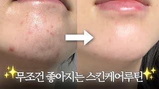 피부 무조건 좋아지는 수부지/여드름/민감성의 나이트🌛스킨케어루틴✨모공 줄어주는 성분/순서/바르는법/꿀팁까지 다 알려드림! 🔥르누베르 3차마켓~18일까지!🔥