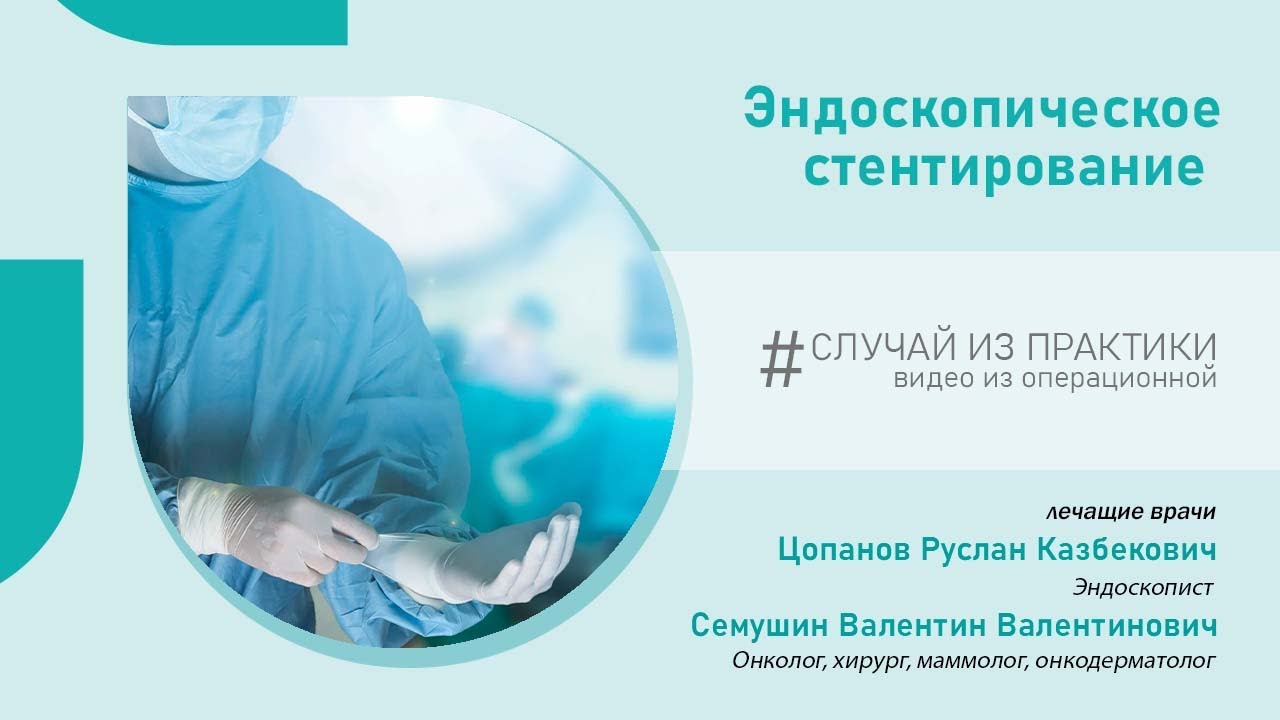 Эндоскопическое стентирование в клинике НАКФФ | Рак ЖКТ