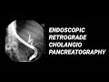 ERCP vs MRCP