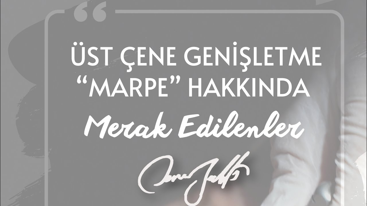 ÜST ÇENE GENİŞLETME “MARPE” HAKKINDA MERAK EDİLENLER - DR. CANER BALTA