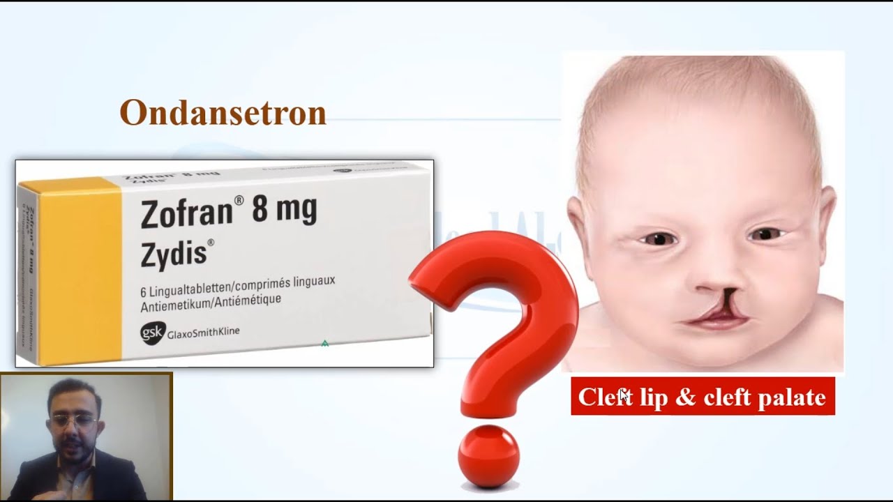 هل دواء (Ondansetron) آمن للحوامل فعلاً ؟؟ وما هي البدائل ؟؟