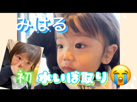 みはる、水イボができたので取りに行きました！！(血や泣き声などが苦手な人注意⚠️)#水イボ