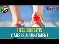 Day -16 || TA Bursitis || PT Assessment and PT management in sports