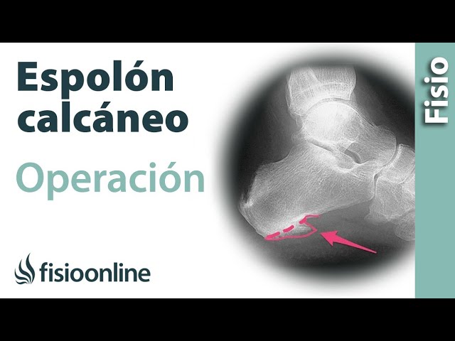 El pie es que izquierdo un en espolon