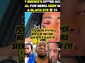 Pop Smoke K***er went live and was seen with a black eye