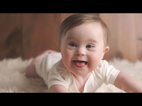 أنواع الإعاقات  متلازمة داون ج1  المركز القبطي للإعاقة الذهنية