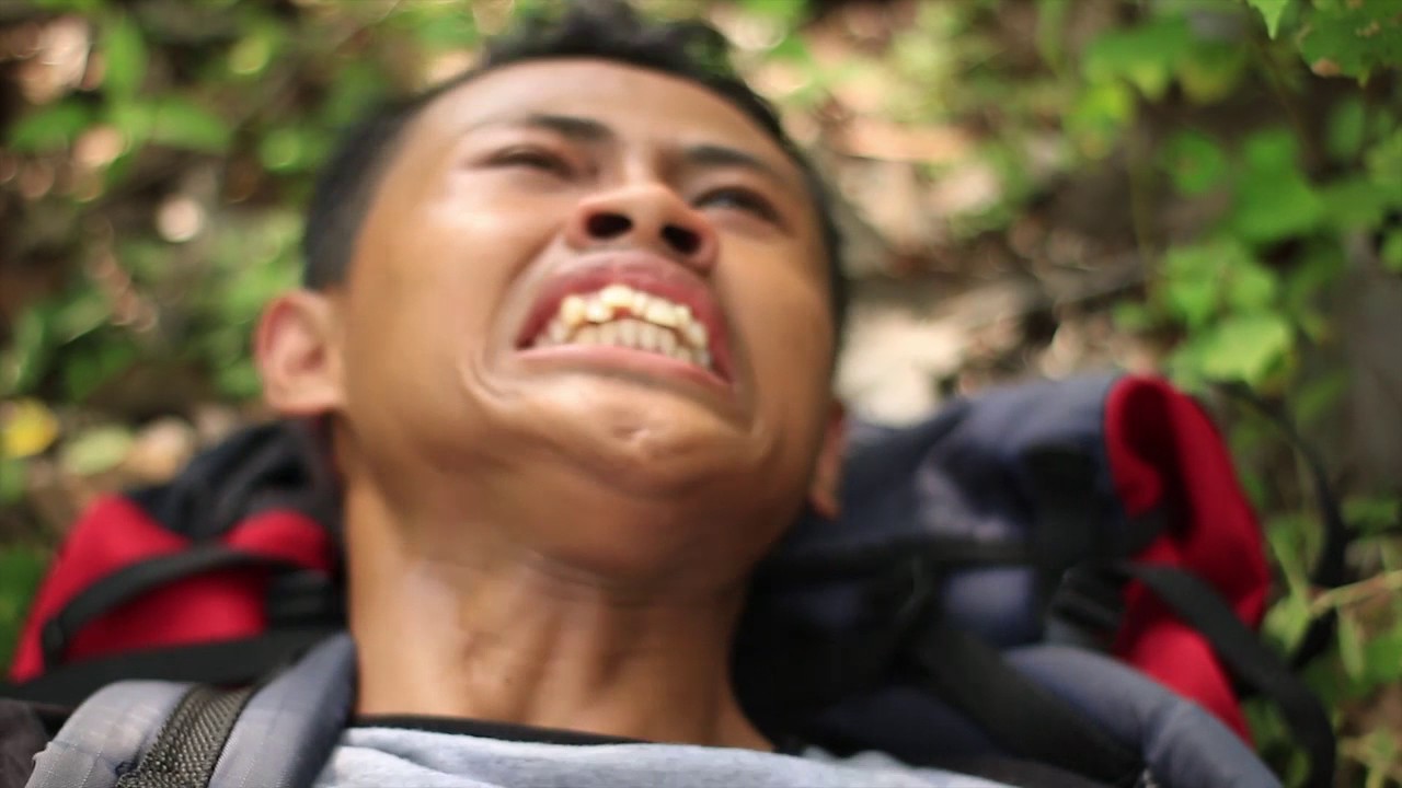PENANGANAN PERTAMA PADA PATAH TULANG - YouTube