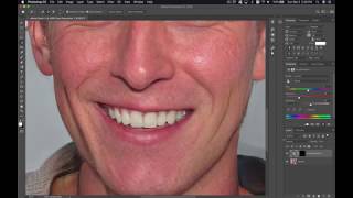 How to Whiten Teeth in Photoshop CC