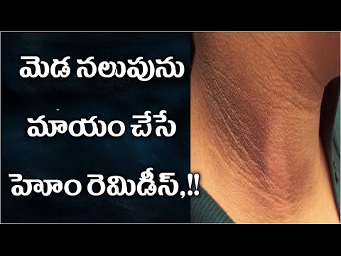 మెడ-నలుపును-మాయం-చేసే-ఎఫెక్టివ్-హోం-రెమెడీస్-|-meda-nalupu-nu-mayam-chesa-effective-home-remidies?